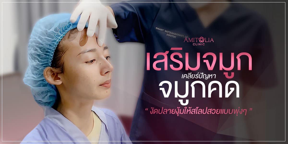 Review เสริมจมูก #113