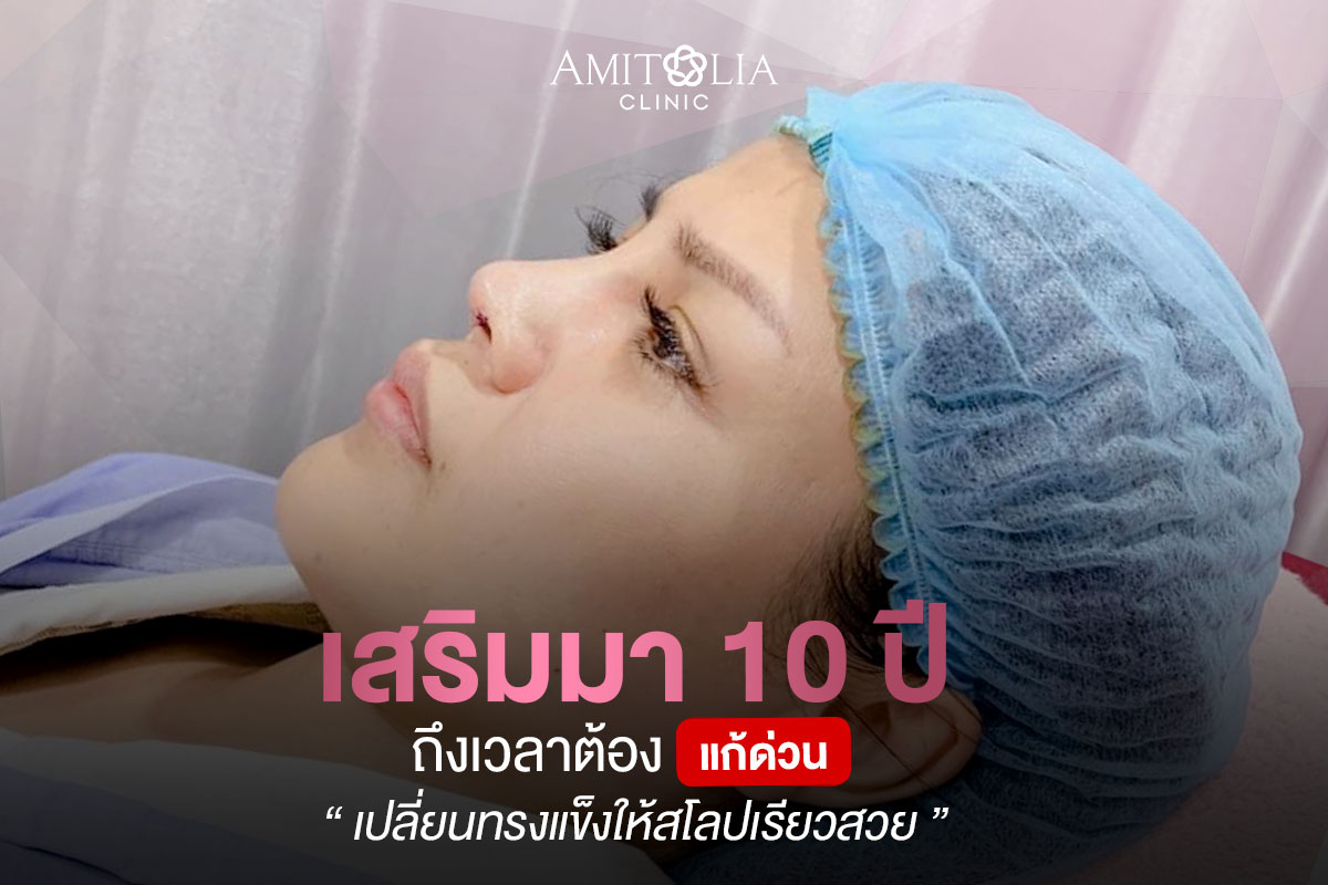 Review แก้จมูก #147