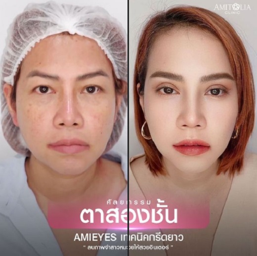 Review ตาสองชั้น #83