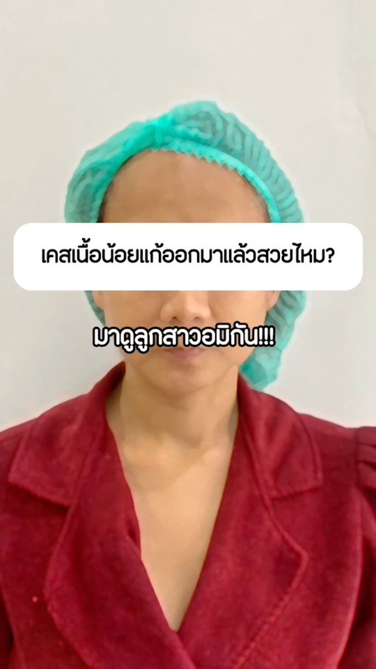 แก้จมูก