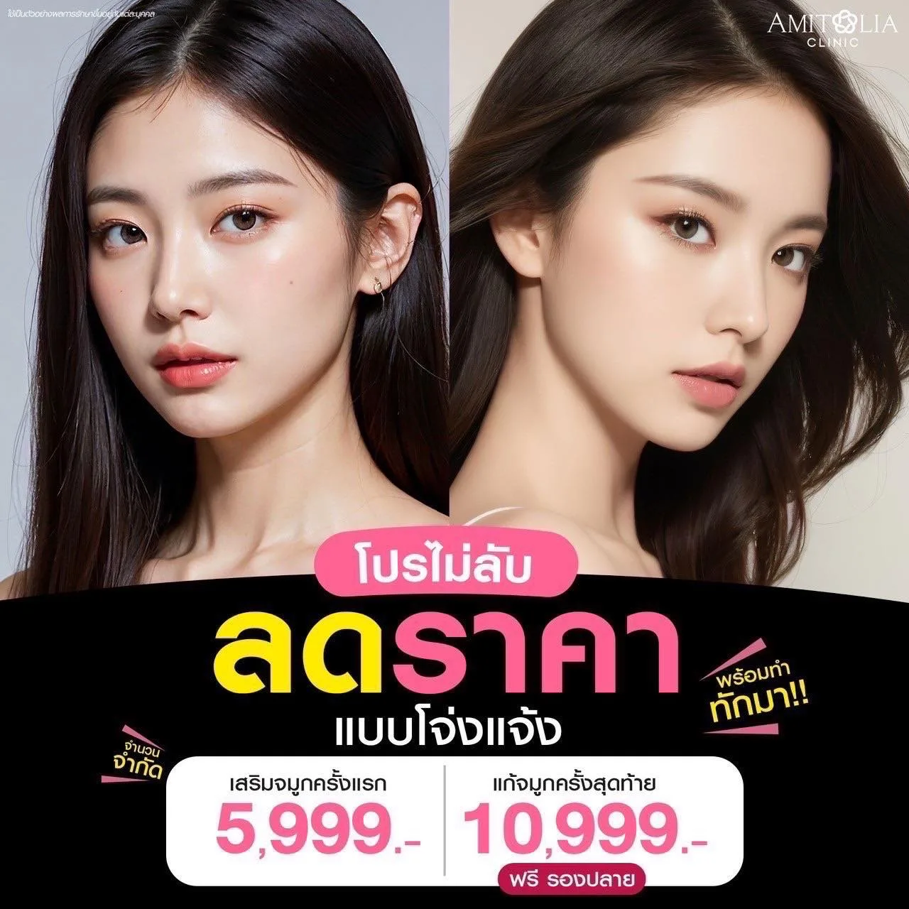 ยังไงต้องรีบจองหน่อยนะคะทางฝ่ายการตลาดประกาศปิดโปรโมชั่น…