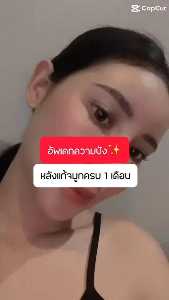 แก้จมูก