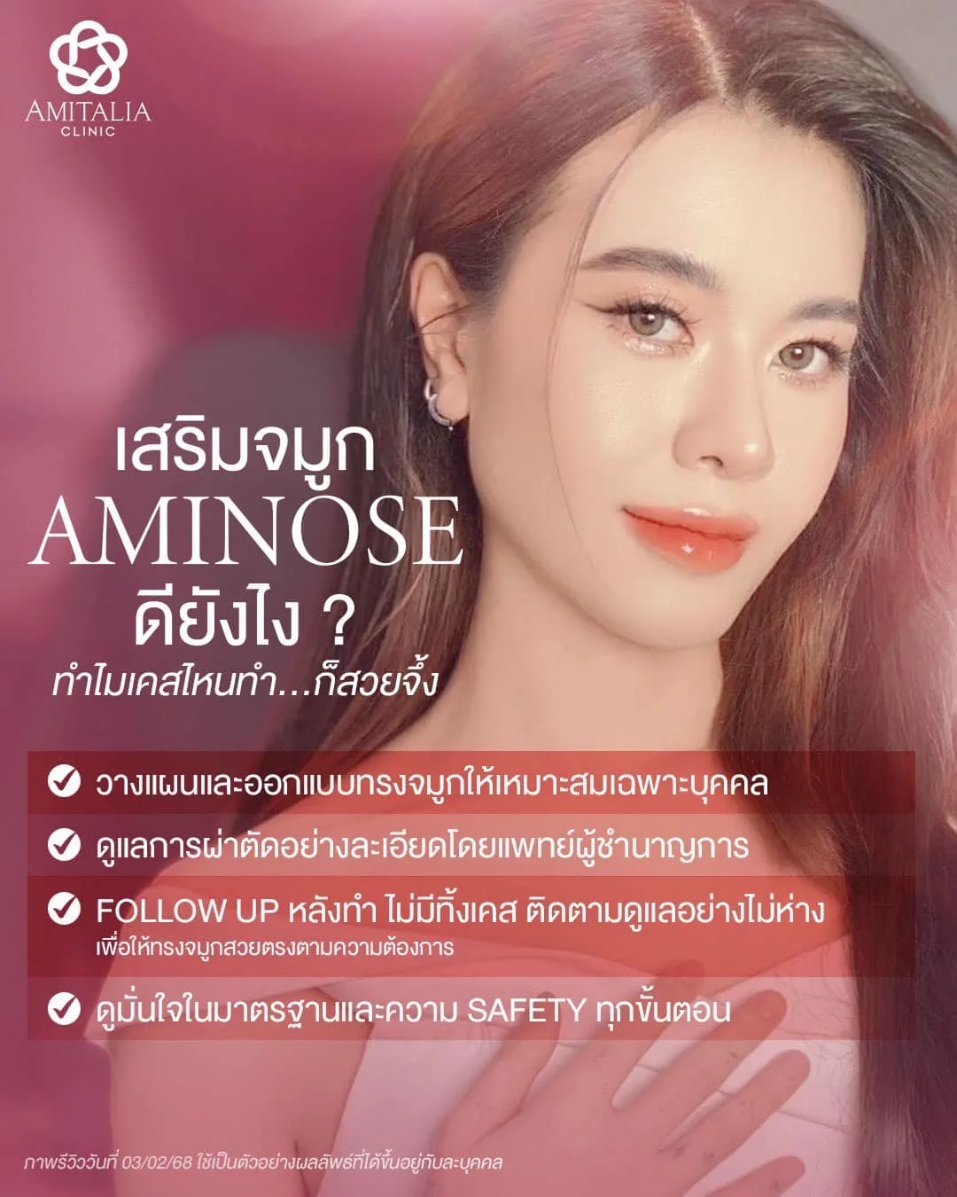 เปิดความลับเสริมจมูก AMINOSE